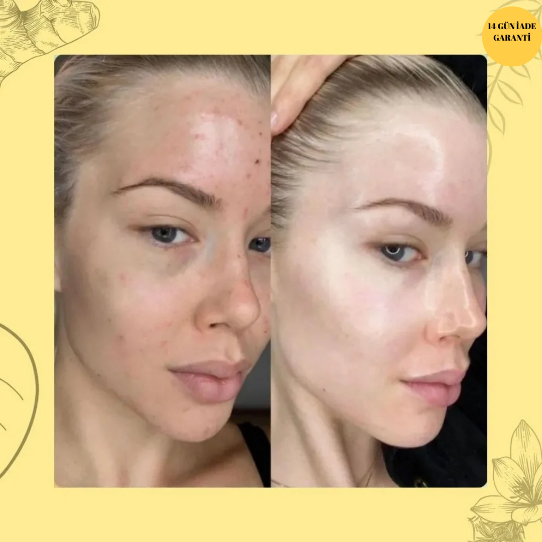 Zerdeçal Beyazlatıcı ve Antiseptik Sabun