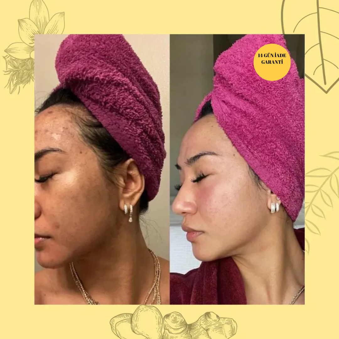 Zerdeçal Beyazlatıcı ve Antiseptik Sabun