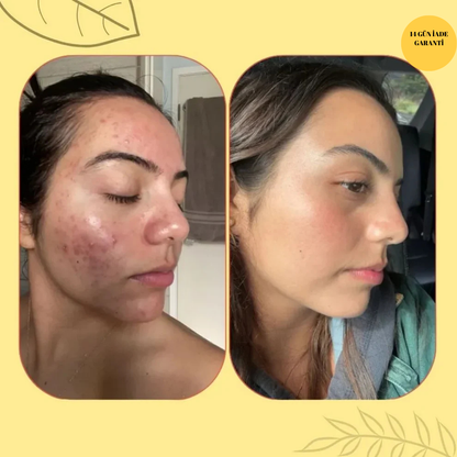 Zerdeçal Beyazlatıcı ve Antiseptik Sabun